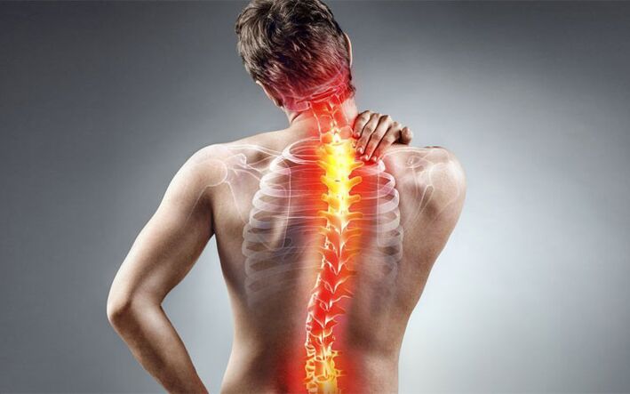 Back pain with skoliosis