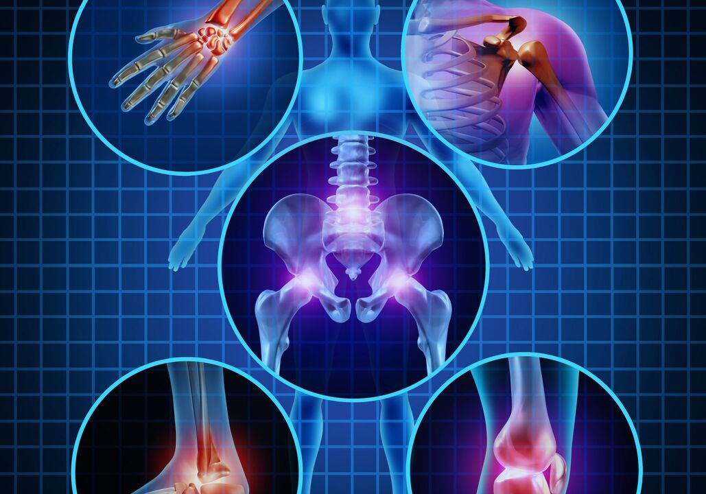 joints affected by arthrosis