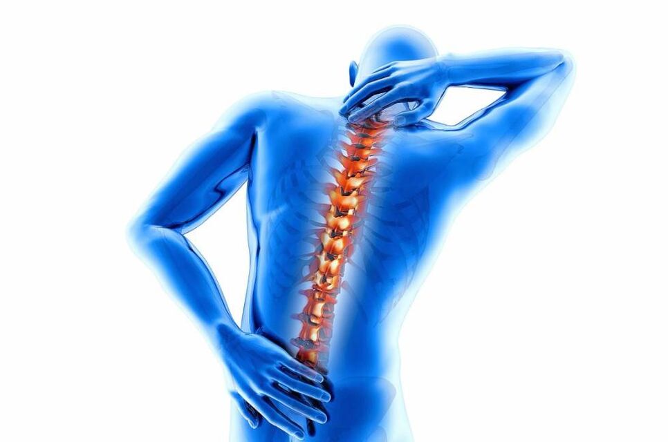 Osteochondrosis is accompanied by thinning of the intervertebral discs